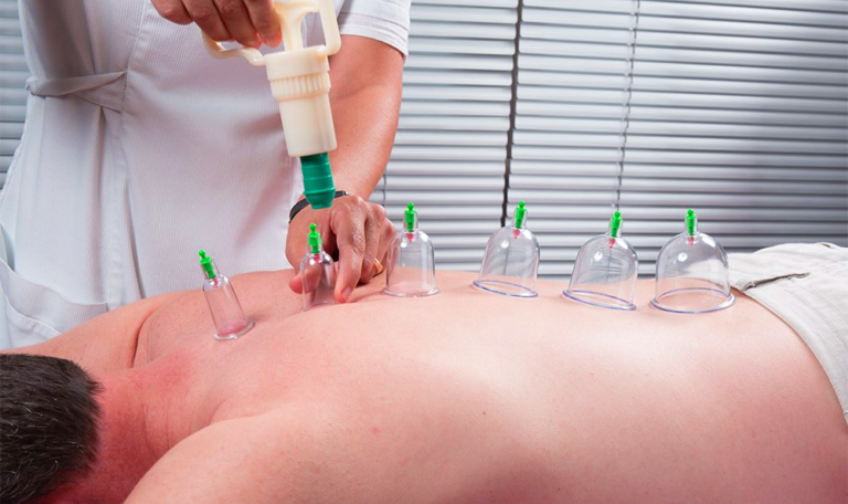 Massage Cupping Benefits